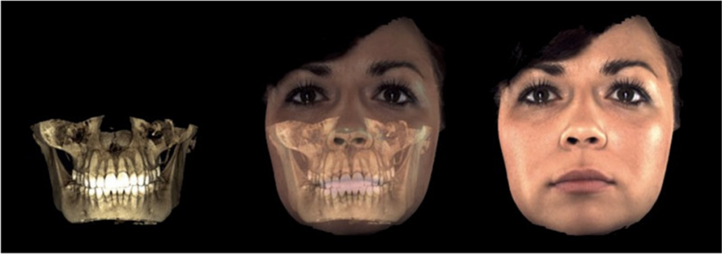 Smile Design con scanner facciale